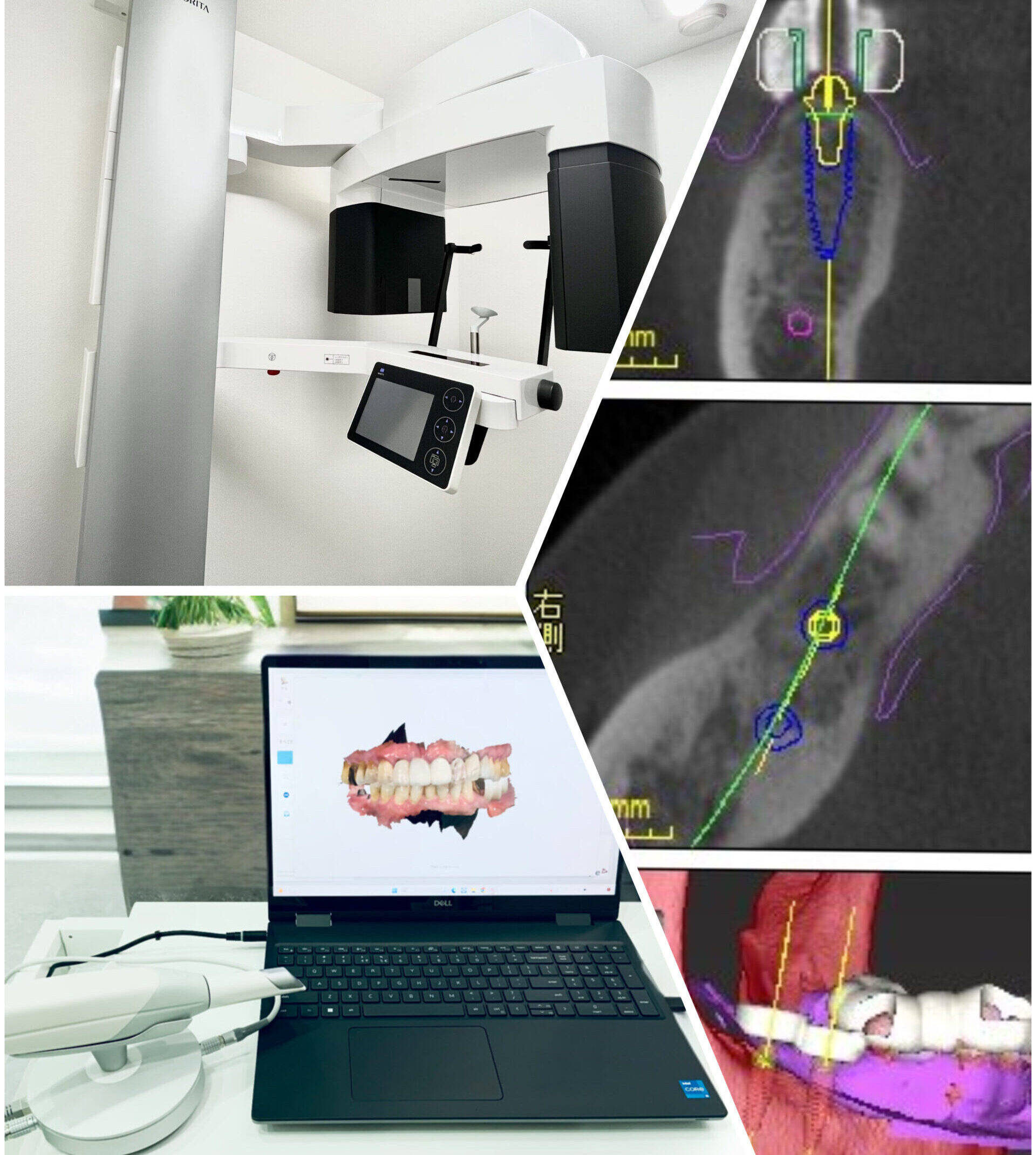 デジタル化に対応した先進的⻭科治療の提供