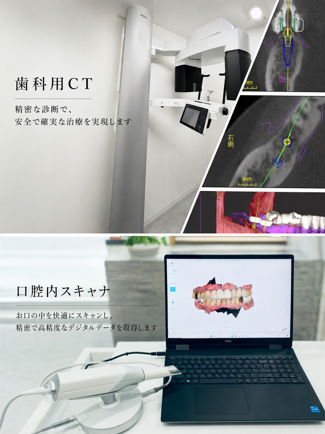 デジタル化に対応した先進的⻭科治療の提供